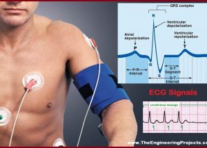 EMG-Electrocardiogram