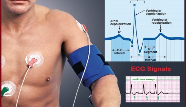 EMG-Electrocardiogram