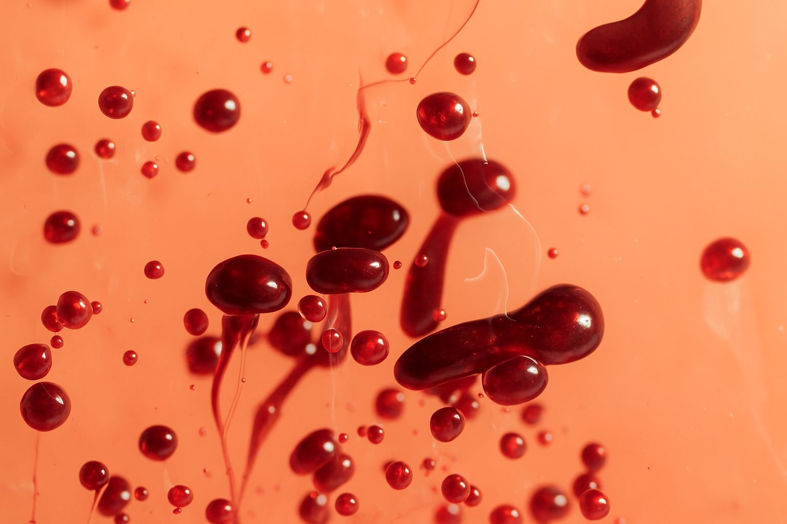 Blood Disorder Treatment in Livingston