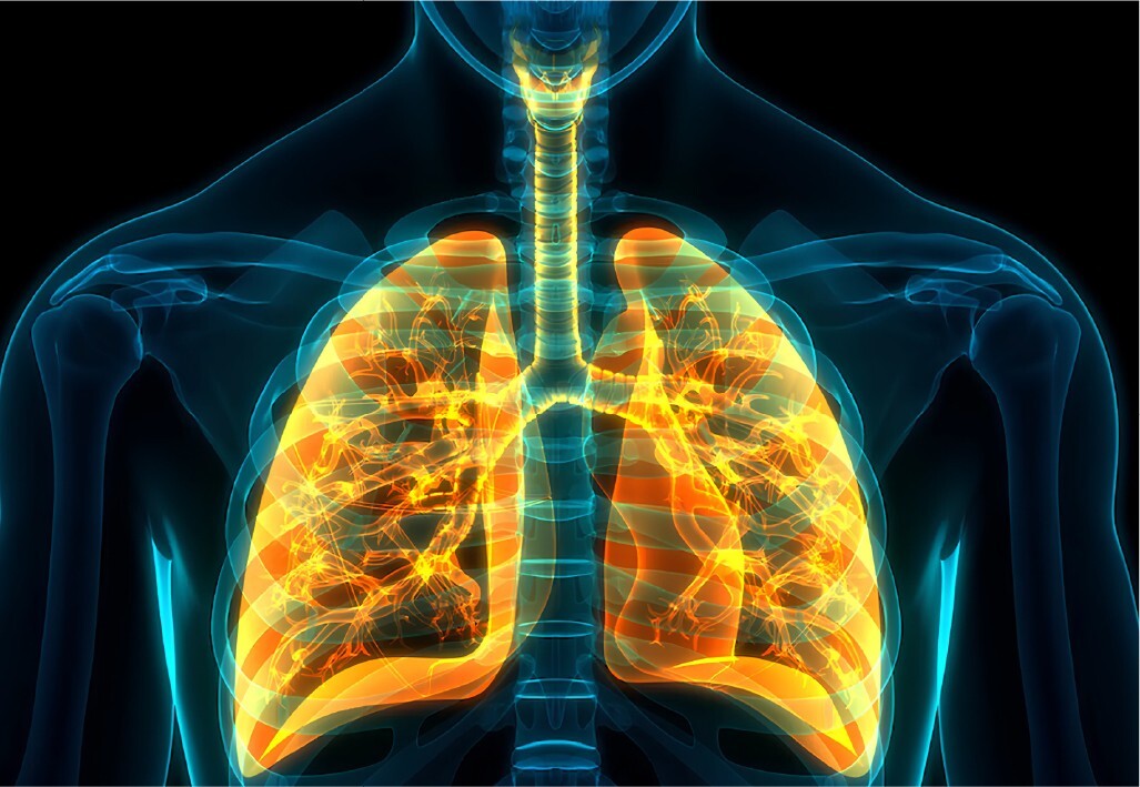 Chronic Obstructive Pulmonary Disease