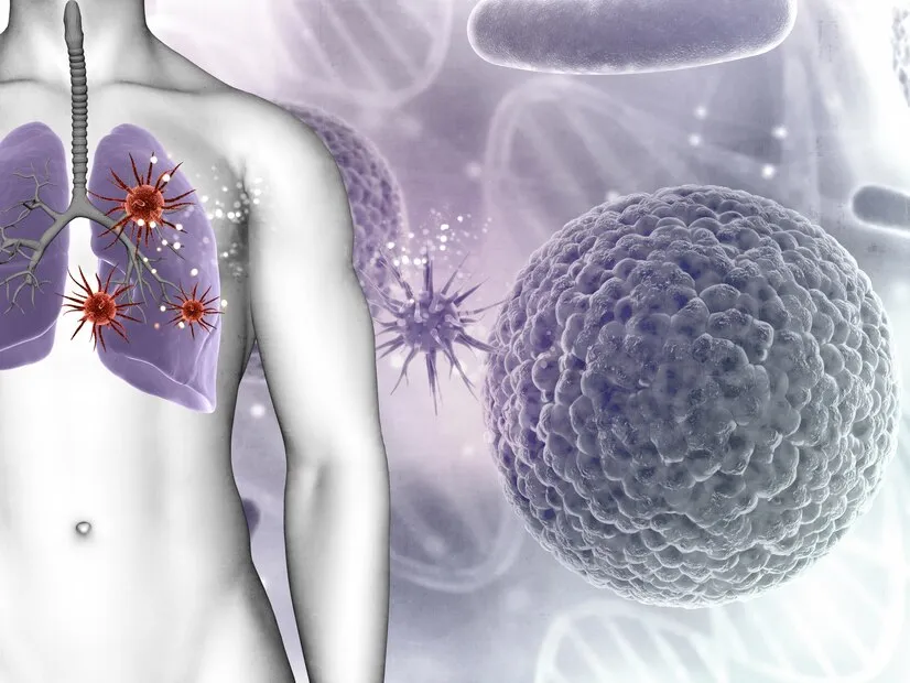 Cystic Fibrosis