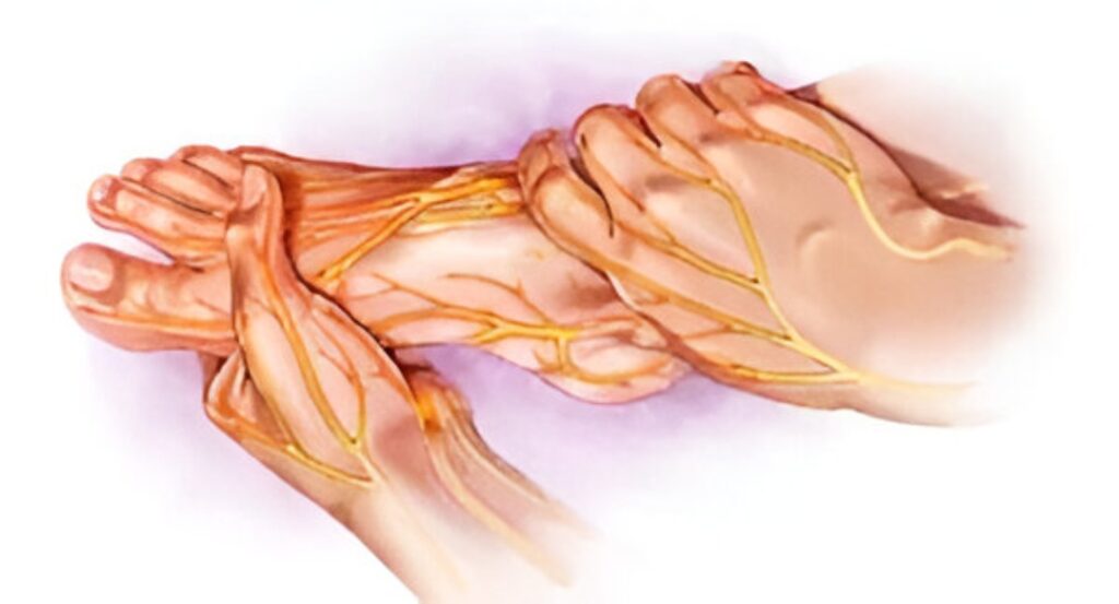 Relief from Neuropathy in Livingston, Texas 9 Dr. G Medical Solutions Neuropathy Treatment