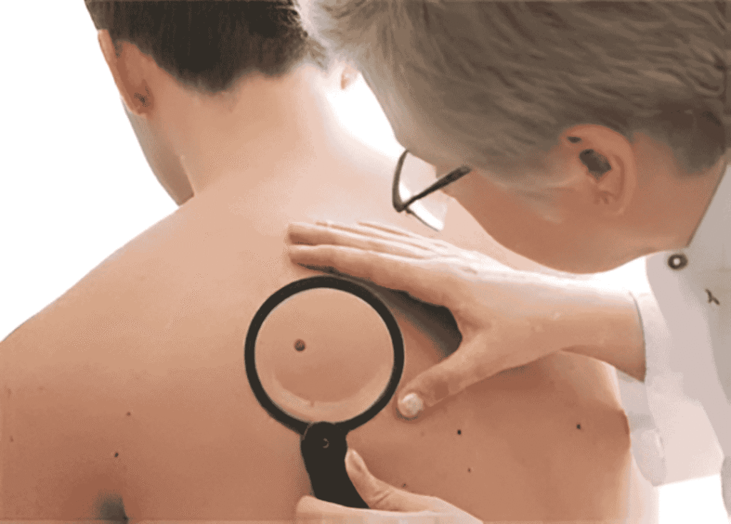 Dr. G Medical Solutions Small Lesion Removal in Livingston, TX