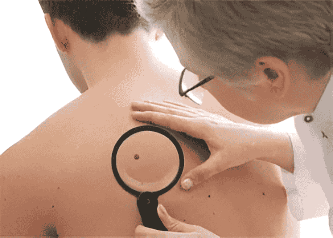 Dr. G Medical Solutions Small Lesion Removal in Livingston, TX