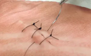 basic-suturing-cover-pic